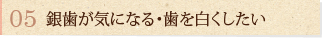 銀歯が気になる・歯を白くしたい